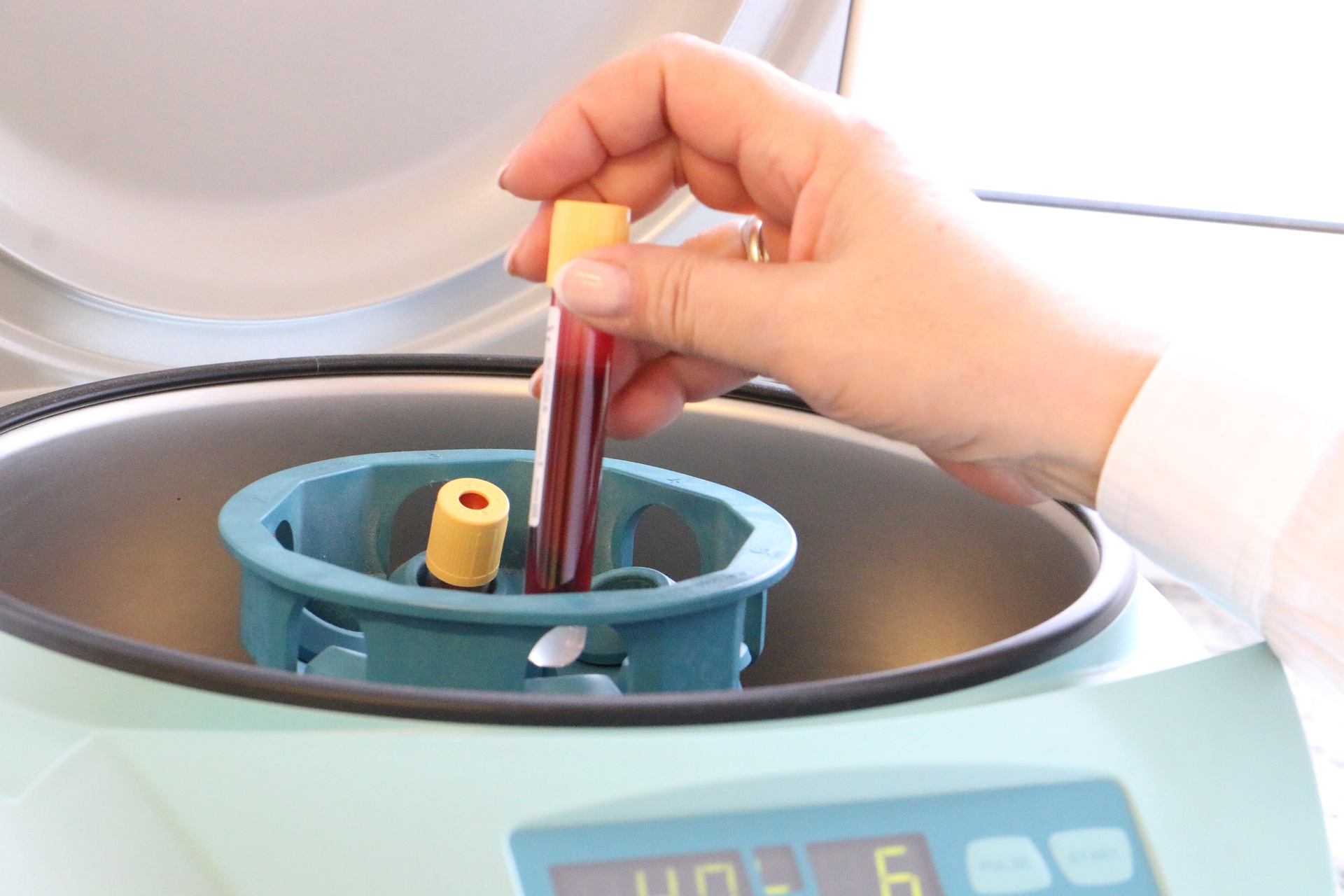 laboratorio di analisi del sangue catania